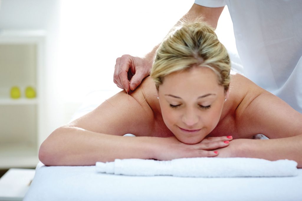 Acupuncture
