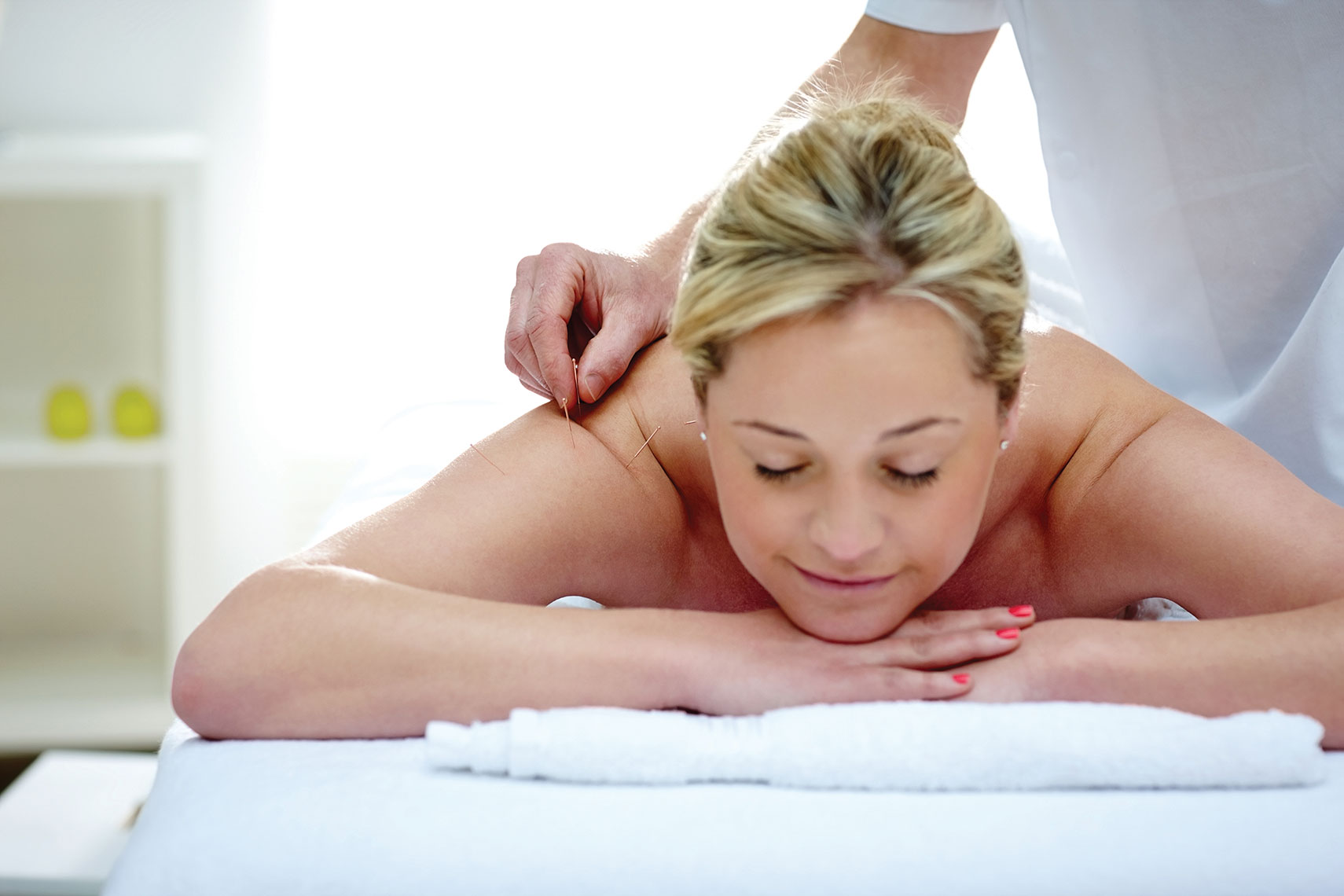 Acupuncture